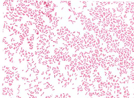 gs-gnr%20ecoli