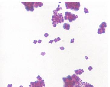 gs-gpc microc2